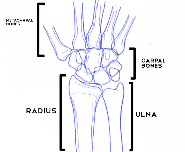 650x535 Wrist Fractures