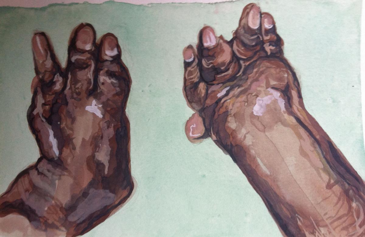 1200x780 Healing Hands The Art And Science Of Arthritis The Leverhulme Trust