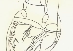 300x210 Draw Diagram