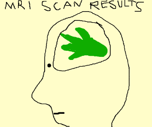 300x250 Kelp For Brains