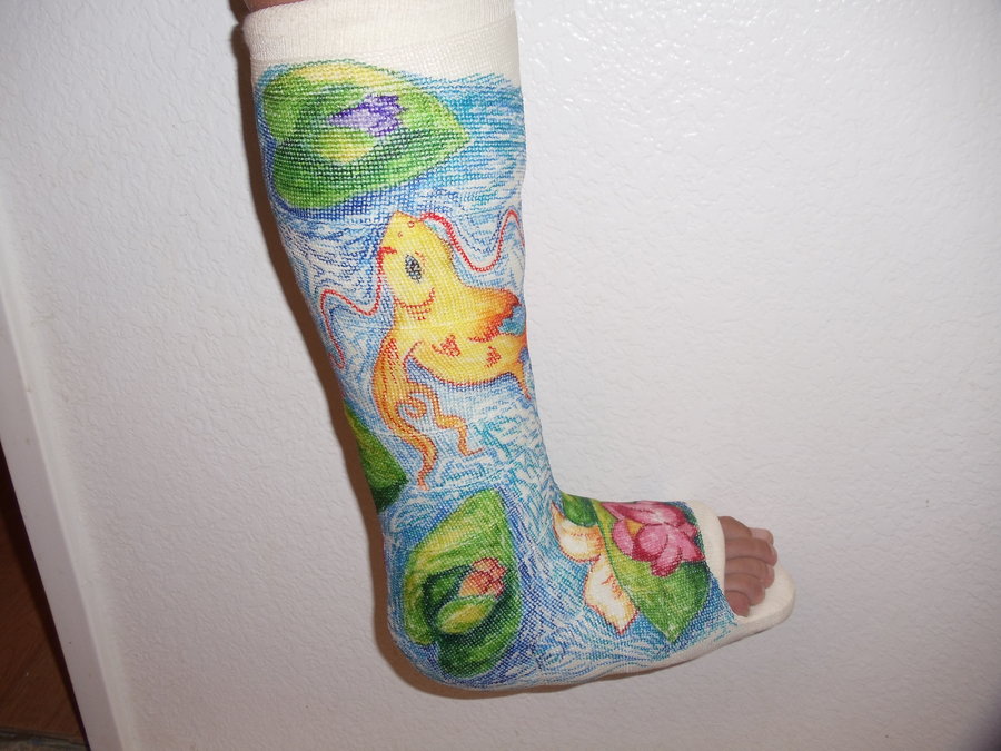 900x675 11 Awesomely Decorated Casts Worth A Broken Bone Mental Floss