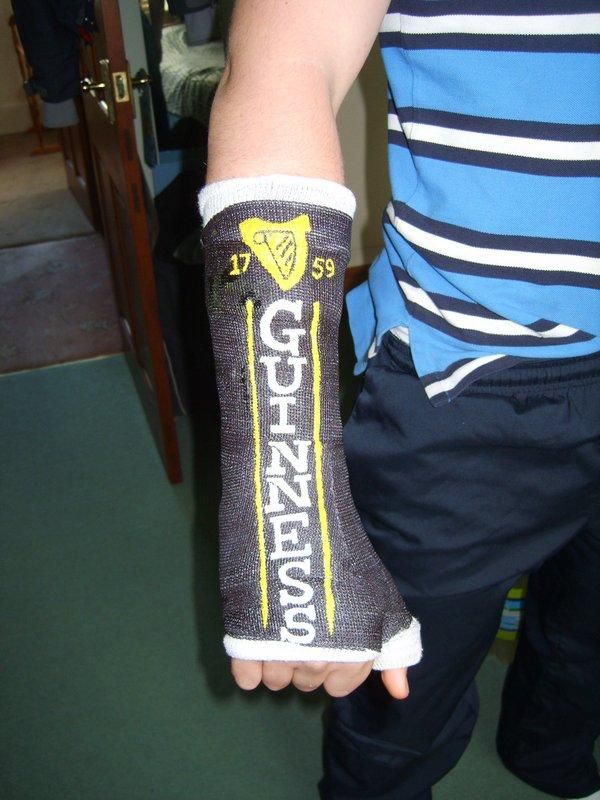 600x800 11 Awesomely Decorated Casts Worth A Broken Bone