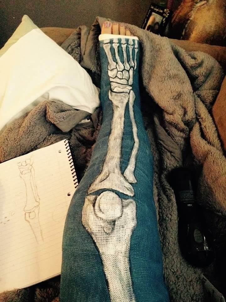 720x960 Awesome Cast Skeleton Drawing Pics