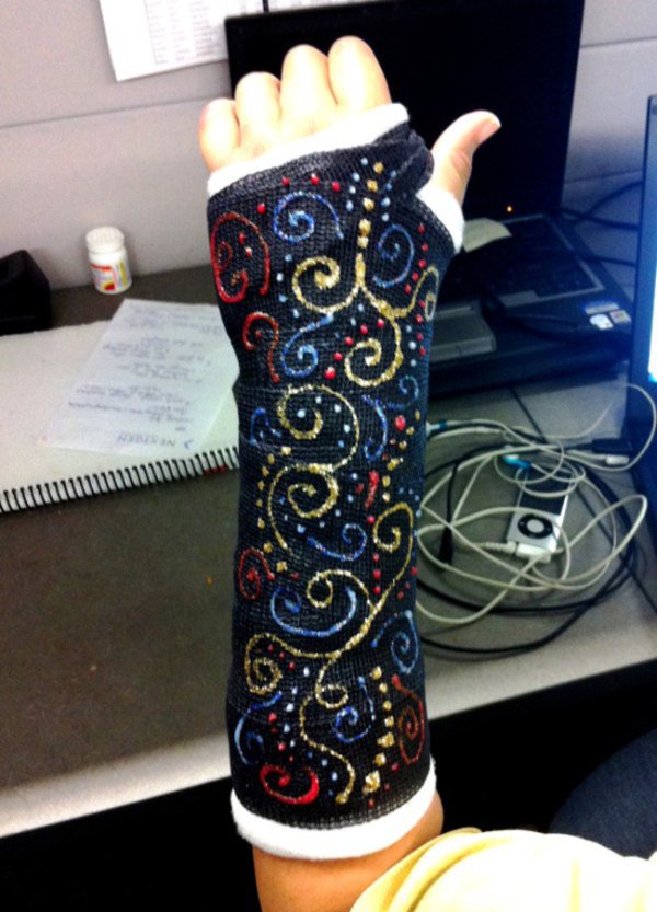 600x833 Cool Cast Art Is A Small Reward For The Pain These People Must'Ve