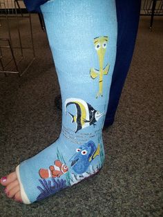 236x314 Full Leg Cast Plastic Cover