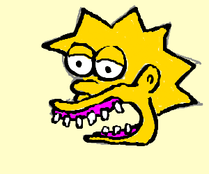 300x250 Lisa Simpson Has Bad (Read British) Teeth.