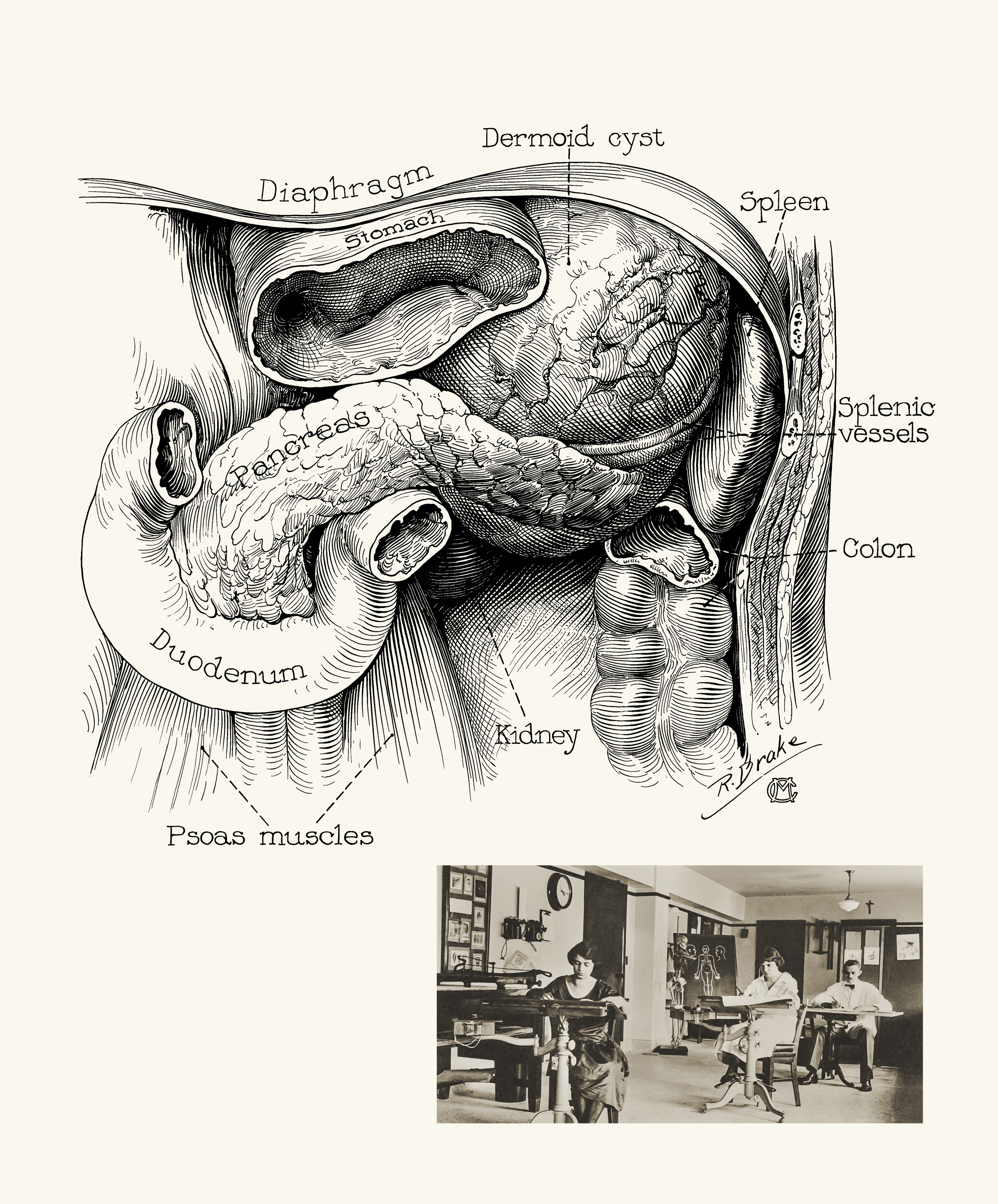 2390x2884 Medical Illustration Clarifies Medical Practice Discovery's Edge