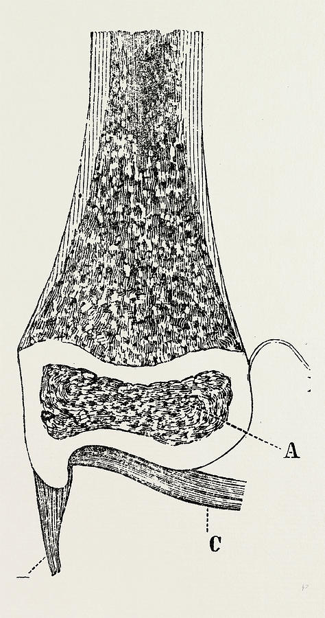 474x900 Lower End Of The Radius, Medical Equipment Drawing By Litz Collection