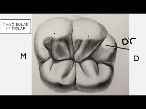 474x355 Drawing A First Upper Molar By Vassnia Nizama