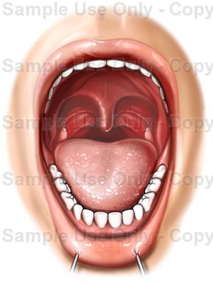 301x400 Mouth Anatomy Open