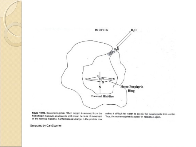 638x479 Ppt Mri Brain