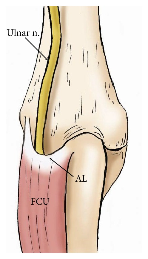 496x867 The Drawing Demonstrates The Course Of The Ulnar Nerve