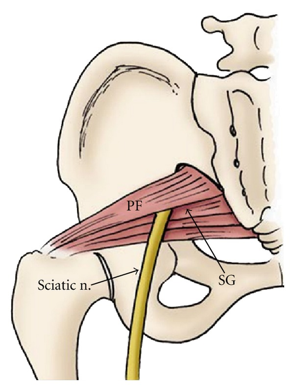 600x795 The Drawing Shows The Proximal Course The Sciatic Nerve Passing