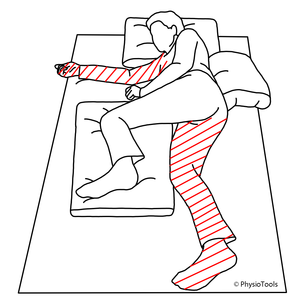 1000x1000 Physical Activity After Stroke Physiospot Physiotherapy