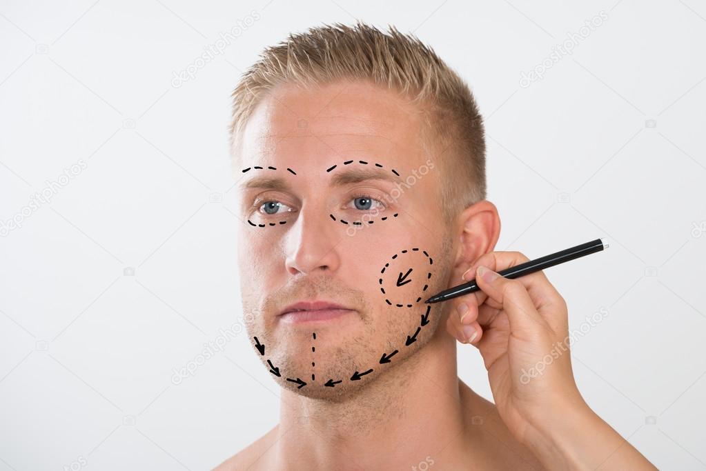1023x683 Correction Mark For Plastic Surgery Stock Photo Andreypopov