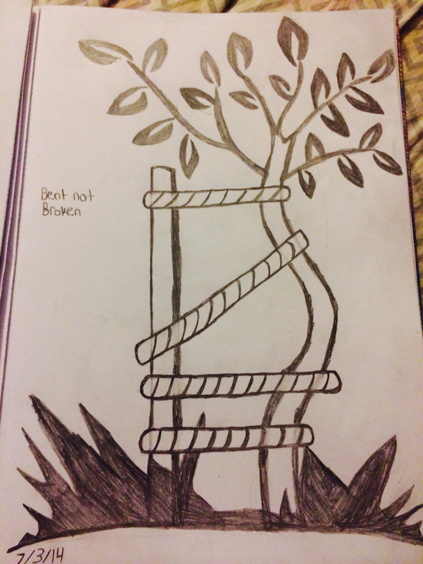 852x1136 Scoliosis Just Drawings Scoliosis