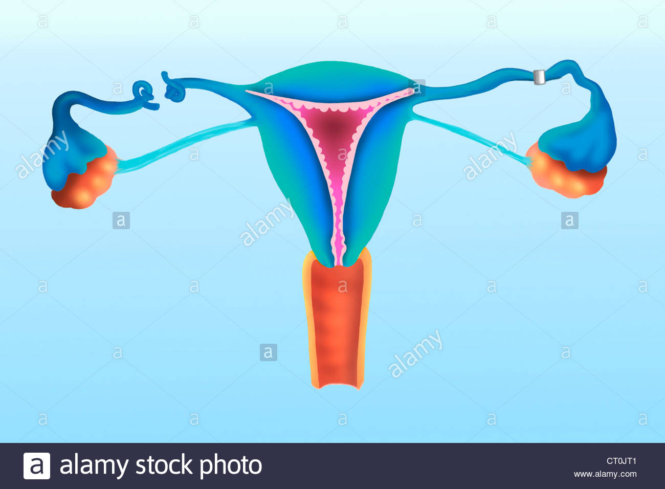 1300x956 Fallopian Tube Surgery, Drawing Stock Photo 49187265
