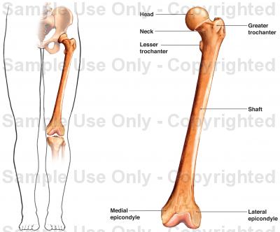 400x332 Femur (Thigh Bone)