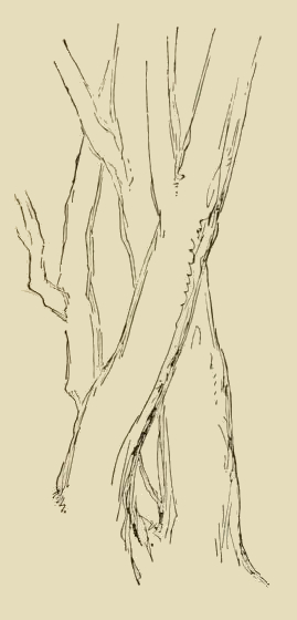 269x560 Tree Trunk Sketch
