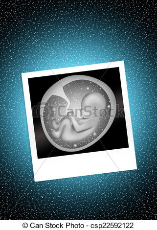 321x470 Illustration Of Ultrasound In Pregnancy Clip Art