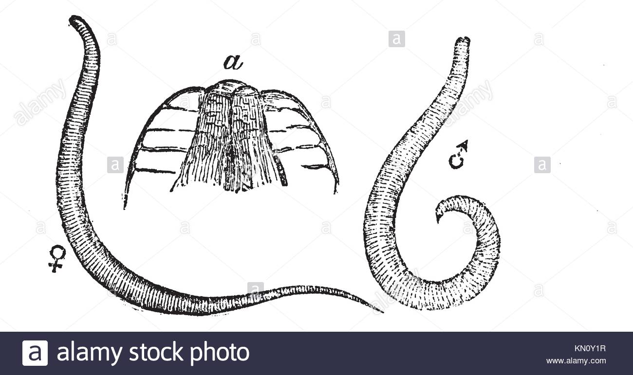 1300x771 Pinworm Stock Photos Amp Pinworm Stock Images