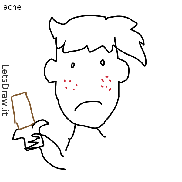 600x600 Acne (Body Part)