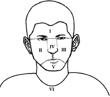 370x327 Six Locations Of The Global Acne Grading System (13).