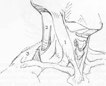 356x289 Back Of The Neck