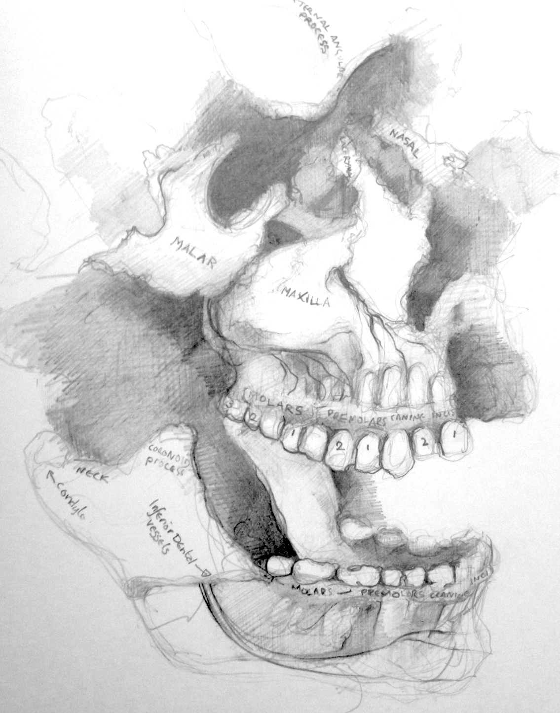 1135x1445 Dundee, Theil Cadavers And Exploded Skulls Disfiguration