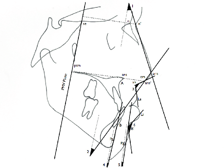 730x547 Angular Measurements Angle Of Dorsum Of The Nose (1) Inclination