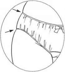 209x230 The Effect Of Underwear And Bathing Suits On The Female Figure