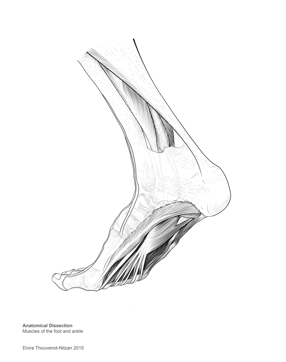 1000x1265 Dissection Drawing