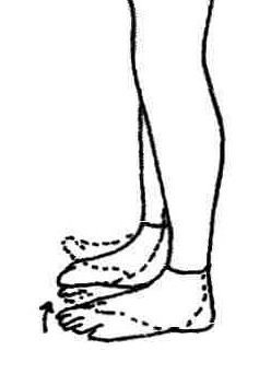 248x342 Ankle Sprains