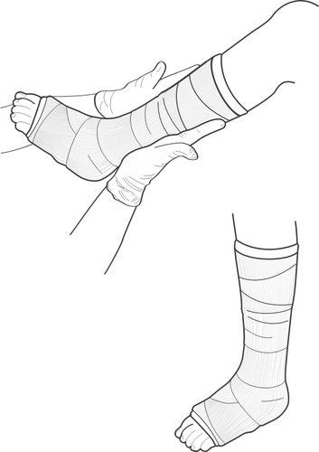 353x500 Vector Illustration Of Leg Cast Examination Public Domain Vectors