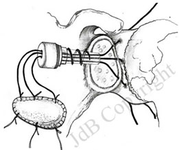 261x218 Cape Shoulder Institute