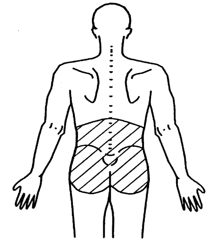 431x480 Low Back Pain And Injury In Athletes (Pathogenesis) Part 1