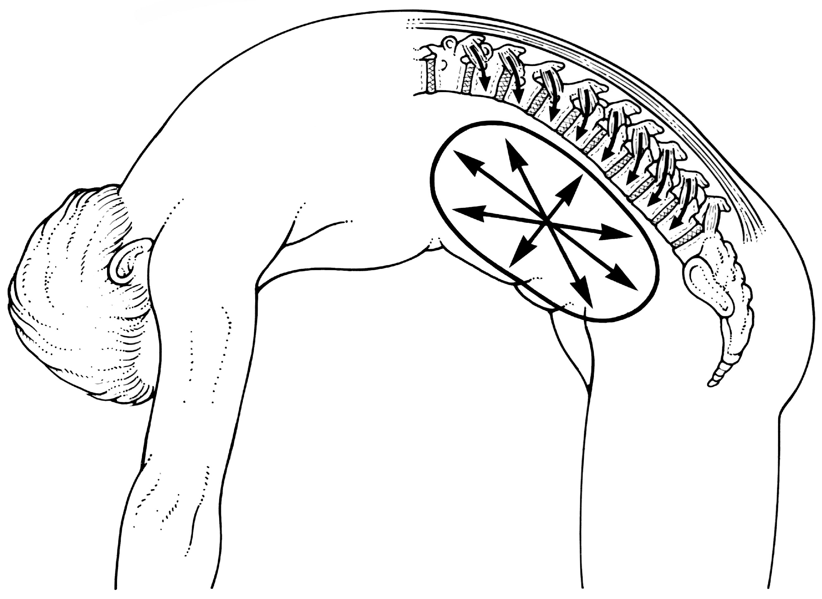 2641x1925 Shearers' Back Pain