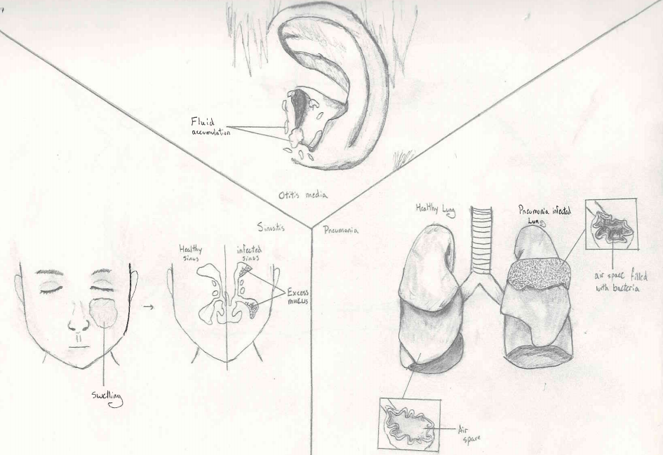945x649 Haemophilus Influenzae Mechanisms Of Pathogenicity