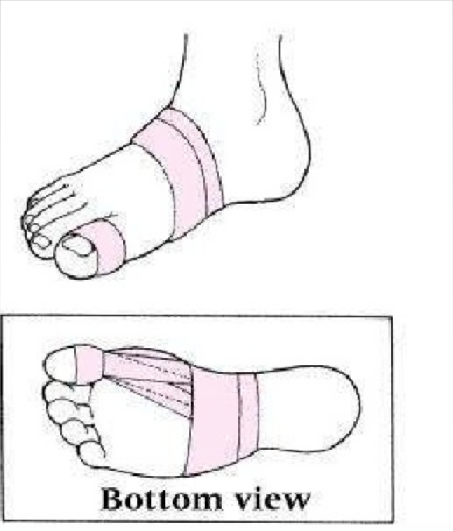 646x756 Big Toe Pain Bjj Rehab