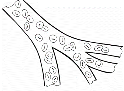 400x295 Diabetic Eye Exams Lucent Vision