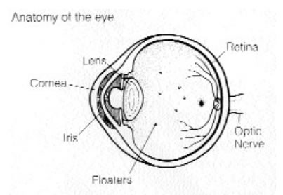 403x278 Floaters Amp Flashes Florida Eye Amp Laser Institute