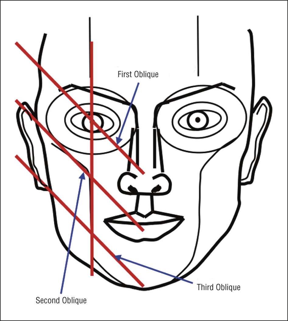 946x1053 Circles Of Prominence A New Theory On Facial Aesthetics Jama