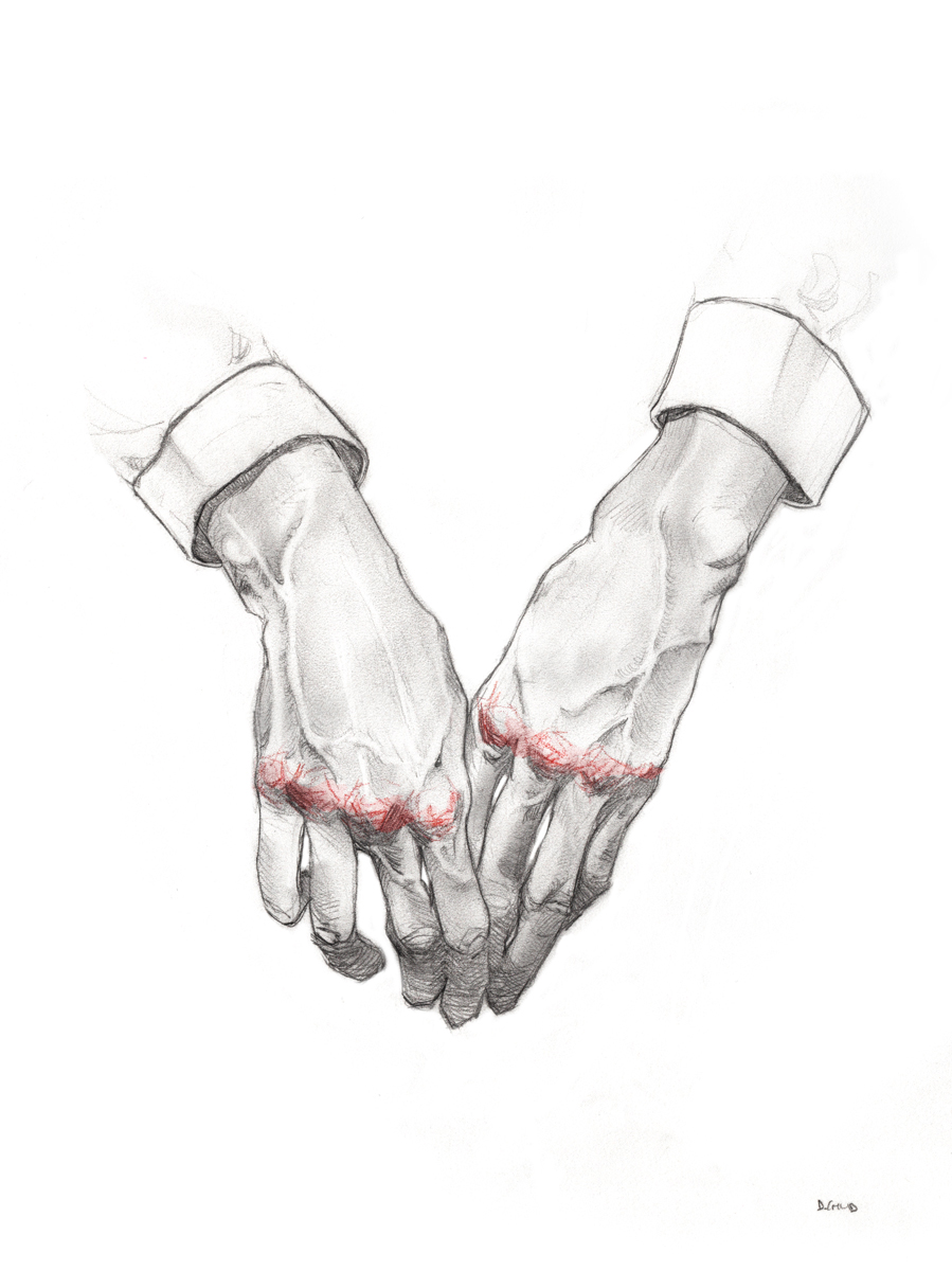 899x1200 Image Result For Bloody Knuckles Art Skylar