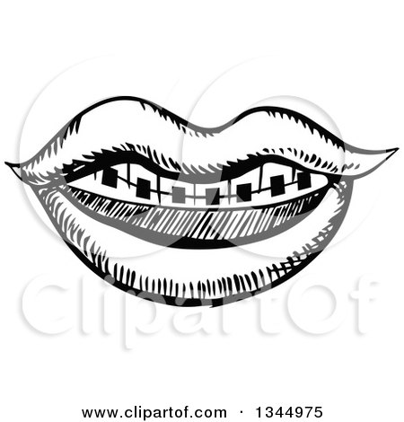 450x470 Clipart Of A Black And White Sketched Mouth With Braces
