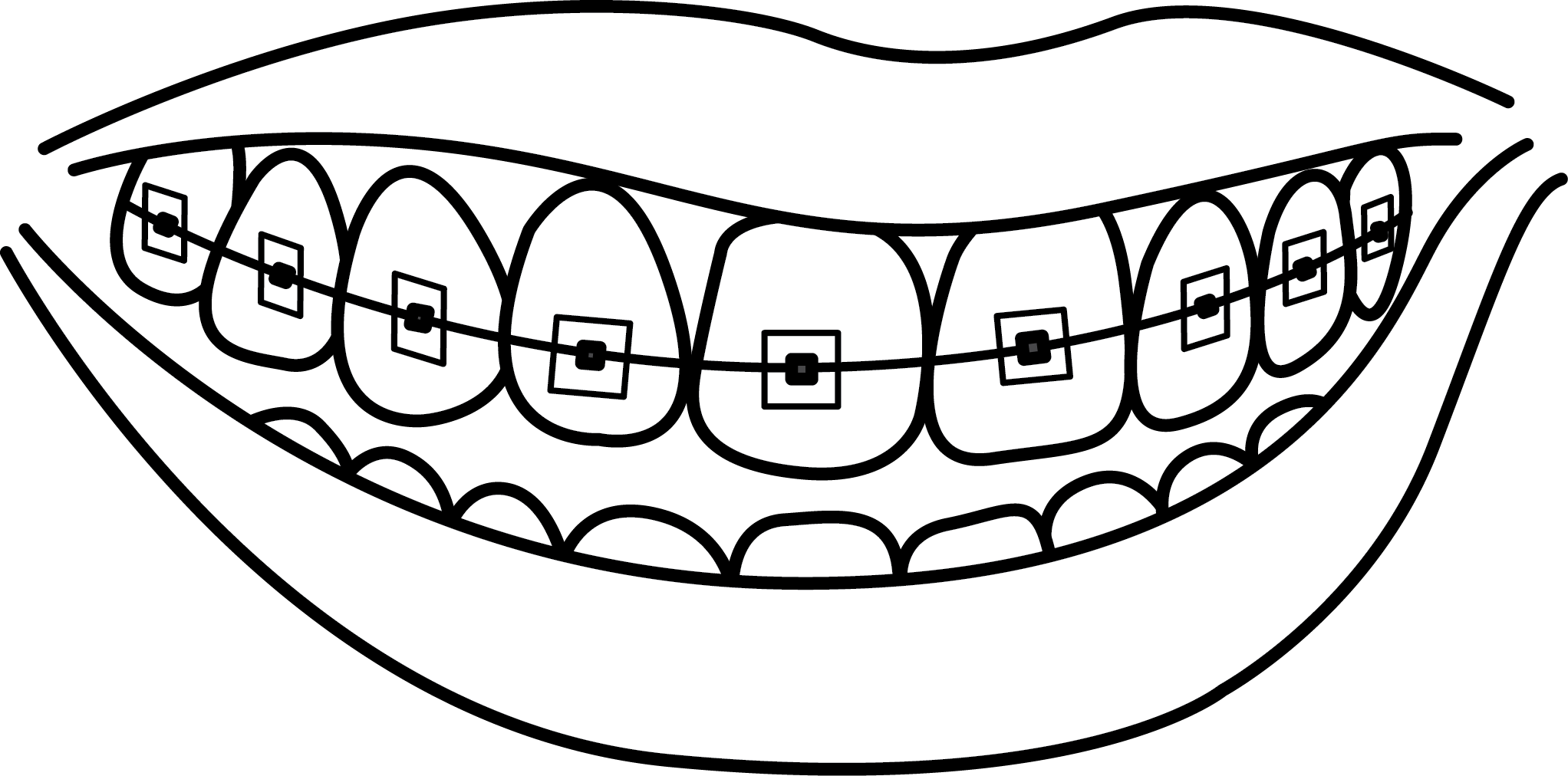 2044x1012 Brace Teeth Clipart