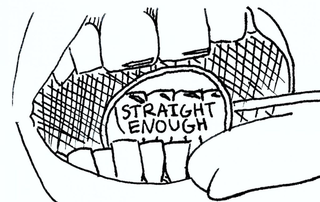 1024x647 Braces A Love Story