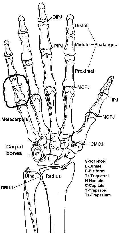 417x815 Is There A Doctor In The House Broken Finger (Xpost Rbr)