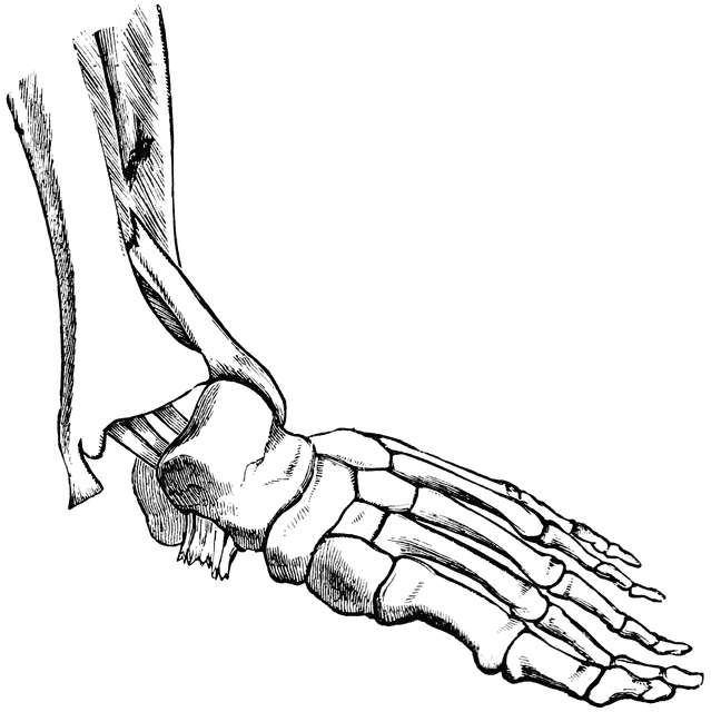 639x640 Fractured Fibula Clipart Etc