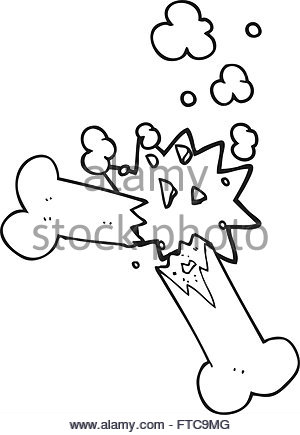 300x435 Freehand Drawn Cartoon Broken Bone Stock Vector Art Amp Illustration