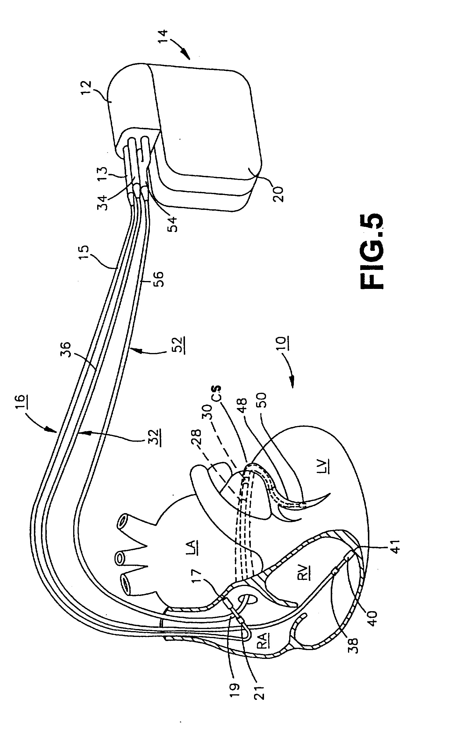 1582x2494 Patent Us20030023280